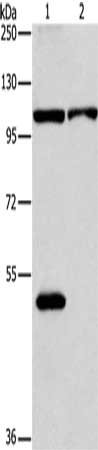 Gel: 8%SDS-PAGE, Lysate: 40 ug, Lane 1-2: K562 cells, hela cells, Primary antibody: CSB-PA993403(NLRP3 Antibody) at dilution 1/88, Secondary antibody: Goat anti rabbit IgG at 1/8000 dilution, Exposure time: 3 minutes