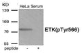Western blot analysis of extracts from HeLa cells treated with Serum using Phospho-ETK (Tyr566) antibody.The lane on the right is treated with the antigen-specific peptide.