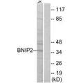 Western blot analysis of extracts from Jurkat cells, using BNIP2 antibody.