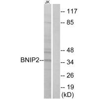 Western blot analysis of extracts from Jurkat cells, using BNIP2 antibody.