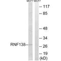 Western blot analysis of extracts from MCF-7 cells, using RNF138 antibody.
