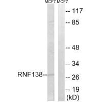 Western blot analysis of extracts from MCF-7 cells, using RNF138 antibody.