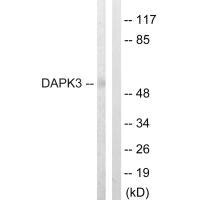 Western blot analysis of extracts from HuvEc cells, using DAPK3 (Ab-265) antibody.