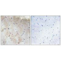 Immunohistochemistry analysis of paraffin-embedded human skeletal muscle tissue using Collagen XII α1 antibody.
