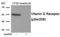 Western blot analysis of extracts from HT29 cells treated with Heatshock using Phospho-Vitamin D Receptor (Ser208) antibody.The lane on the right is treated with the antigen-specific peptide.