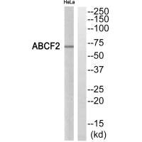 Western blot analysis of extracts from HeLa cells, using ABCF2 antibody.