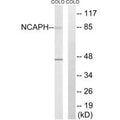Western blot analysis of extracts from COLO cells, using NCAPH antibody.