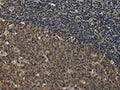 The image on the left is immunohistochemistry of paraffin-embedded Human tonsil tissue using CSB-PA995563(SETD7 Antibody) at dilution 1/20, on the right is treated with fusion protein. (Original magnification: ×200)