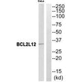 Western blot analysis of extracts from CoLo cells, using BCL2L12 antibody.