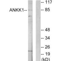 Western blot analysis of extracts from HeLa cells, using ANKK1 antibody.