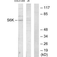 Western blot analysis of extracts from COLO205 cells and Jurkat cells, using S6K antibody.