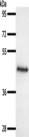 Gel: 10%SDS-PAGE, Lysate: 60 ug, Lane: Human liver cancer tissue, Primary antibody: CSB-PA997043(SSTR5 Antibody) at dilution 1/300, Secondary antibody: Goat anti rabbit IgG at 1/8000 dilution, Exposure time: 3 minutes