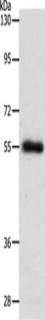 Gel: 8%SDS-PAGE, Lysate: 40 ug, Lane: Mouse lung tissue, Primary antibody: CSB-PA997190(SLC1A5 Antibody) at dilution 1/600, Secondary antibody: Goat anti rabbit IgG at 1/8000 dilution, Exposure time: 10 minutes