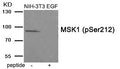 Western blot analysis of extracts from NIH-3T3 cells treated with EGF using MSK1 (Phospho-Ser212) antibody.The lane on the right is treated with the antigen-specific peptide.