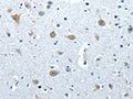 The image on the left is immunohistochemistry of paraffin-embedded Human brain tissue using CSB-PA997514(COX7B2 Antibody) at dilution 1/20, on the right is treated with fusion protein. (Original magnification: ×200)