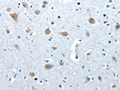 The image on the left is immunohistochemistry of paraffin-embedded Human brain tissue using CSB-PA997514(COX7B2 Antibody) at dilution 1/20, on the right is treated with fusion protein. (Original magnification: ×200)