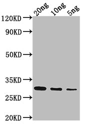Western Blot
Positive WB detected in Recombinant protein
All lanes: NAM8 antibody at 1:2000
Secondary
Goat polyclonal to rabbit IgG at 1/50000 dilution
Predicted band size: 28.2 kDa
Observed band size: 30 kDa