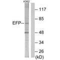Western blot analysis of extracts from K562 cells, using ZNF147 antibody.