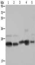 Gel: 10%SDS-PAGE, Lysate: 40 ug, Lane 1-5: Jurkat cells, Raji cells, A431 cells, mouse skeletal muscle tissue, NIH/3T3 cells, Primary antibody: CSB-PA998153(NDUFV2 Antibody) at dilution 1/250, Secondary antibody: Goat anti rabbit IgG at 1/8000 dilution, Exposure time: 5 seconds