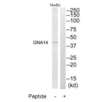Western blot analysis of extracts from HuvEc cells, using GNA14 antibody.