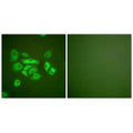 Immunofluorescence analysis of A549 cells, using Keratin 10 antibody.