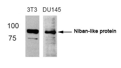 Western blot analysis of extracts from 3T3 and DU145 cells using Niban-like protein(Ab-712) antibody.