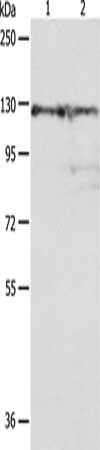 Gel: 8%SDS-PAGE, Lysate: 40 ug, Lane 1-2: Hela cells, human liver cancer tissue, Primary antibody: CSB-PA998614(PC Antibody) at dilution 1/100, Secondary antibody: Goat anti rabbit IgG at 1/8000 dilution, Exposure time: 30 seconds