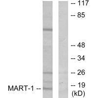 Western blot analysis of extracts from NIH/3T3 cells, using MART-1 antibody.
