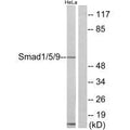Western blot analysis of extracts from HeLa cells, using Smad1/5/9 antibody.