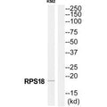 Western blot analysis of extracts from K562 cells, using RPS18 antibody.