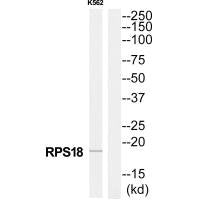 Western blot analysis of extracts from K562 cells, using RPS18 antibody.