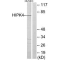 Western blot analysis of extracts from HUVEC cells, using HIPK4 antibody.