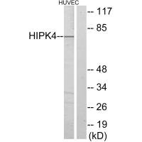 Western blot analysis of extracts from HUVEC cells, using HIPK4 antibody.