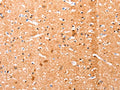 The image on the left is immunohistochemistry of paraffin-embedded Human brain tissue using CSB-PA999540(EFNA1 Antibody) at dilution 1/51, on the right is treated with fusion protein. (Original magnification: ×200)