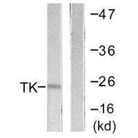 Western blot analysis of extracts from COLO205 cells, using TK (Ab-13) antibody.