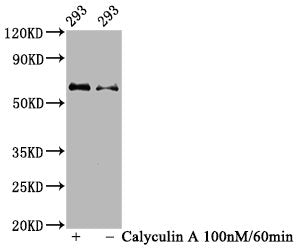 Western Blot
Positive WB detected in 293 whole cell lysate(treated with Calyculin A or not) 
All lanes Phospho-AKT1 antibody at 1.08μg/ml
Secondary
Goat polyclonal to rabbit IgG at 1/50000 dilution
Predicted band size: 60 KDa
Observed band size: 60 KDa