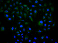 Immunofluorescence staining of Hela cell with CSB-RA001553MA1HU at 1:30 ,counter-stained with DAPI. The cells were fixed in 4% formaldehyde, permeabilized using 0.2% Triton X-100 and blocked in 10% normal Goat Serum. The cells were then incubated with the antibody overnight at 4°C. The secondary antibody was Fluorescein (FITC) AffiniPure Goat Anti-Human IgG, Fcγ fragment specific.