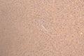 IHC image of CSB-RA001703MA1HU diluted at 1：50 and staining in paraffin-embedded human liver tissue performed on a Leica BondTM system. After dewaxing and hydration, antigen retrieval was mediated by high pressure in a citrate buffer (pH 6.0) . Section was blocked with 10% normal goat serum 30min at RT. Then primary antibody (1% BSA) was incubated at 4°C overnight. The primary is detected by a Anti-Human lgG, Fcy Fragment Specific labeled by HRP and visualized using 0.05% DAB.