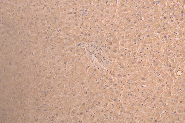 IHC image of CSB-RA001703MA1HU diluted at 1：50 and staining in paraffin-embedded human liver tissue performed on a Leica BondTM system. After dewaxing and hydration, antigen retrieval was mediated by high pressure in a citrate buffer (pH 6.0) . Section was blocked with 10% normal goat serum 30min at RT. Then primary antibody (1% BSA) was incubated at 4°C overnight. The primary is detected by a Anti-Human lgG, Fcy Fragment Specific labeled by HRP and visualized using 0.05% DAB.
