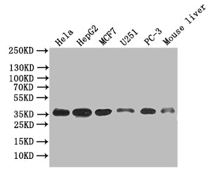 Western Blot
Positive WB detected in: Hela whole cell lysate, HepG2 whole cell lysate, MCF7 whole cell lysate, U251 whole cell lysate, PC-3 whole cell lysate, Mouse Liver tissue lysate
All lanes: ANXA4 antibody at 1:500
Secondary
Goat polyclonal to mouse IgG at 1/50000 dilution
Predicted band size: 36 kDa
Observed band size: 36 kDa