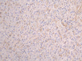 IHC image of CSB-RA001898MA1HUU diluted at 1:100 and staining in paraffin-embedded human liver tissue performed on a Leica BondTM system. After dewaxing and hydration, antigen retrieval was mediated by high pressure in a citrate buffer (pH 6.0) . Section was blocked with 10% normal goat serum 30min at RT. Then primary antibody (1% BSA) was incubated at 4°C overnight. The primary is detected by a Goat anti-human polymer IgG labeled by HRP and visualized using 0.05% DAB.