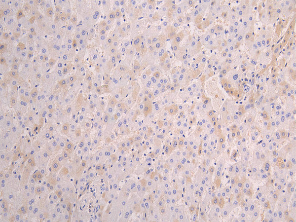 IHC image of CSB-RA001898MA1HUU diluted at 1:100 and staining in paraffin-embedded human liver tissue performed on a Leica BondTM system. After dewaxing and hydration, antigen retrieval was mediated by high pressure in a citrate buffer (pH 6.0) . Section was blocked with 10% normal goat serum 30min at RT. Then primary antibody (1% BSA) was incubated at 4°C overnight. The primary is detected by a Goat anti-human polymer IgG labeled by HRP and visualized using 0.05% DAB.