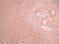 IHC image of CSB-RA001939MA1HU diluted at 1:50 and staining in paraffin-embedded human liver tissue performed on a Leica BondTM system. After dewaxing and hydration, antigen retrieval was mediated by high pressure in a citrate buffer (pH 6.0). Section was blocked with 10% normal goat serum 30min at RT. Then primary antibody (1% BSA) was incubated at 4°C overnight. The primary is detected by a Anti-Human lgG, Fcy Fragment Specific labeled by HRP and visualized using 0.05% DAB.