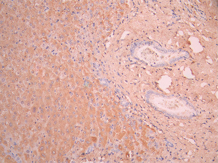 IHC image of CSB-RA001939MA1HU diluted at 1:50 and staining in paraffin-embedded human liver tissue performed on a Leica BondTM system. After dewaxing and hydration, antigen retrieval was mediated by high pressure in a citrate buffer (pH 6.0). Section was blocked with 10% normal goat serum 30min at RT. Then primary antibody (1% BSA) was incubated at 4°C overnight. The primary is detected by a Anti-Human lgG, Fcy Fragment Specific labeled by HRP and visualized using 0.05% DAB.