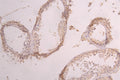 IHC image of CSB-RA001950MA2HU diluted at 1：50 and staining in paraffin-embedded human testis tissue performed on a Leica BondTM system. After dewaxing and hydration, antigen retrieval was mediated by high pressure in a citrate buffer (pH 6.0) . Section was blocked with 10% normal goat serum 30min at RT. Then primary antibody (1% BSA) was incubated at 4°C overnight. The primary is detected by a Goat anti-human polymer IgG labeled by HRP and visualized using 0.05% DAB.