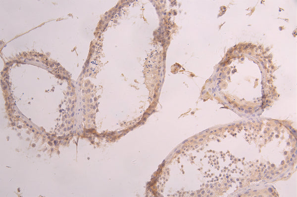 IHC image of CSB-RA001950MA2HU diluted at 1：50 and staining in paraffin-embedded human testis tissue performed on a Leica BondTM system. After dewaxing and hydration, antigen retrieval was mediated by high pressure in a citrate buffer (pH 6.0) . Section was blocked with 10% normal goat serum 30min at RT. Then primary antibody (1% BSA) was incubated at 4°C overnight. The primary is detected by a Goat anti-human polymer IgG labeled by HRP and visualized using 0.05% DAB.