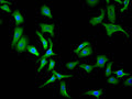 Immunofluorescence staining of Hela cell with CSB-RA001950MA3HU at 1:30, counter-stained with DAPI. The cells were fixed in 4% formaldehyde and blocked in 10% normal Goat Serum. The cells were then incubated with the antibody overnight at 4C. The secondary antibody was FITC-conjugated AffiniPure Goat Anti-Human IgG(H+L) .