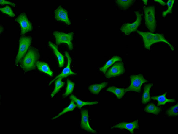 Immunofluorescence staining of Hela cell with CSB-RA001950MA3HU at 1:30, counter-stained with DAPI. The cells were fixed in 4% formaldehyde and blocked in 10% normal Goat Serum. The cells were then incubated with the antibody overnight at 4C. The secondary antibody was FITC-conjugated AffiniPure Goat Anti-Human IgG(H+L) .