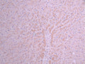 IHC image of CSB-RA002005MA1HU diluted at 1:50 and staining in paraffin-embedded human liver tissue performed on a Leica BondTM system. After dewaxing and hydration, antigen retrieval was mediated by high pressure in a citrate buffer (pH 6.0). Section was blocked with 10% normal goat serum 30min at RT. Then primary antibody (1% BSA) was incubated at 4°C overnight. The primary is detected by a Anti-Human lgG, Fcy Fragment Specific labeled by HRP and visualized using 0.05% DAB.