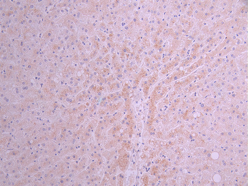 IHC image of CSB-RA002005MA1HU diluted at 1:50 and staining in paraffin-embedded human liver tissue performed on a Leica BondTM system. After dewaxing and hydration, antigen retrieval was mediated by high pressure in a citrate buffer (pH 6.0). Section was blocked with 10% normal goat serum 30min at RT. Then primary antibody (1% BSA) was incubated at 4°C overnight. The primary is detected by a Anti-Human lgG, Fcy Fragment Specific labeled by HRP and visualized using 0.05% DAB.